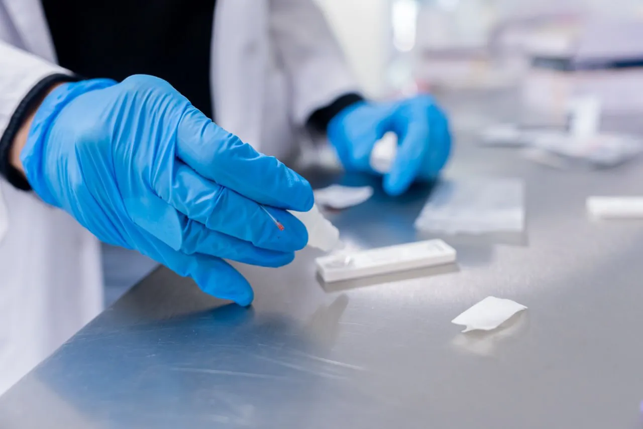 Desde el próximo lunes se realizarán testeos gratuitos de “Hepatitis C”