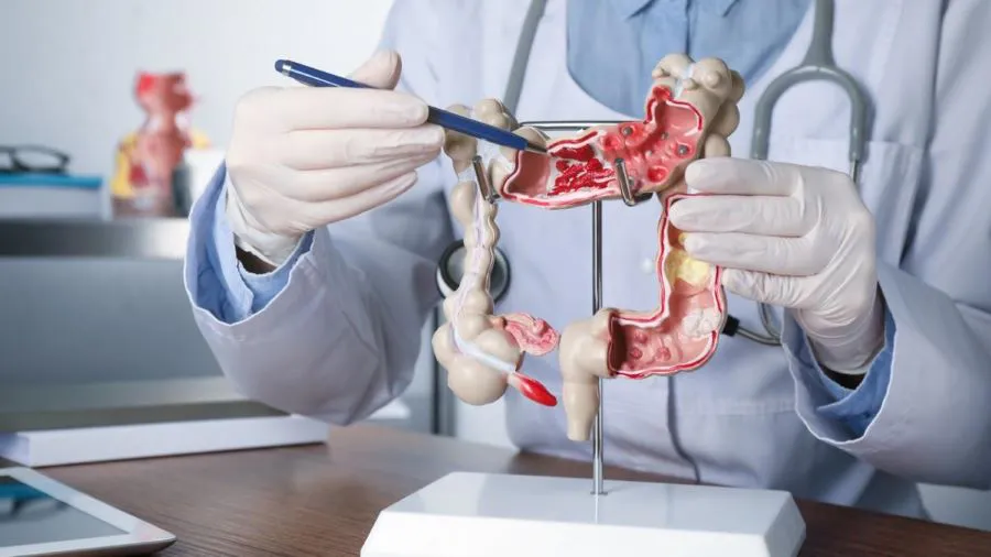 colon-model-1200x675-1-1